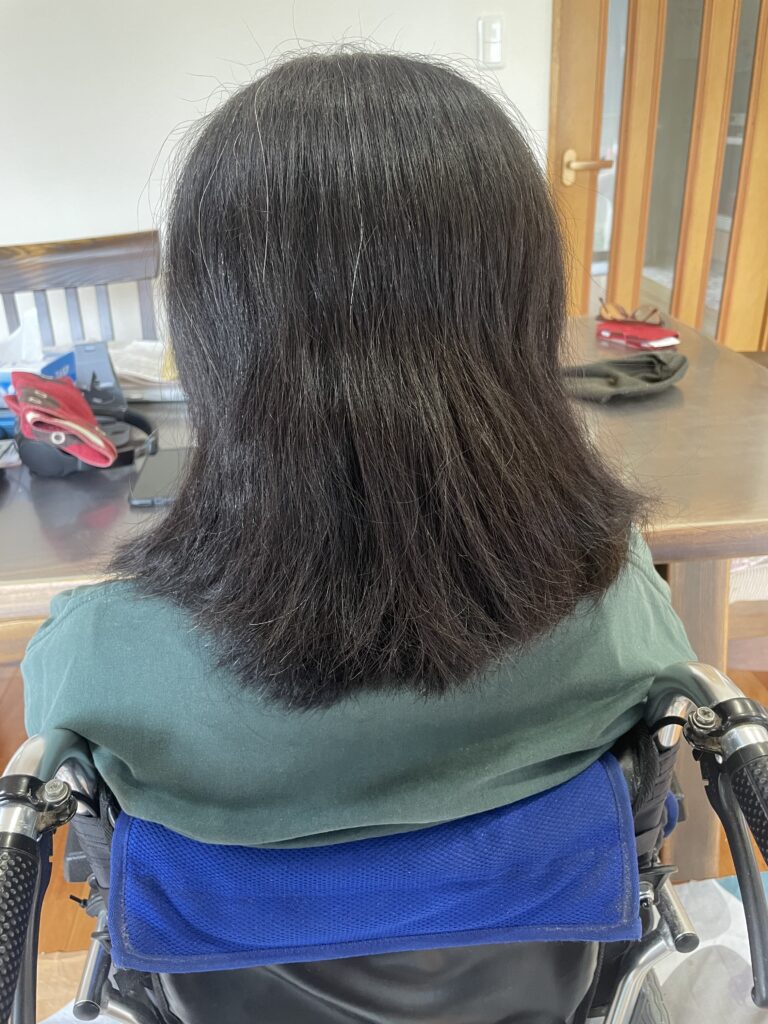 訪問美容 施術前の状態